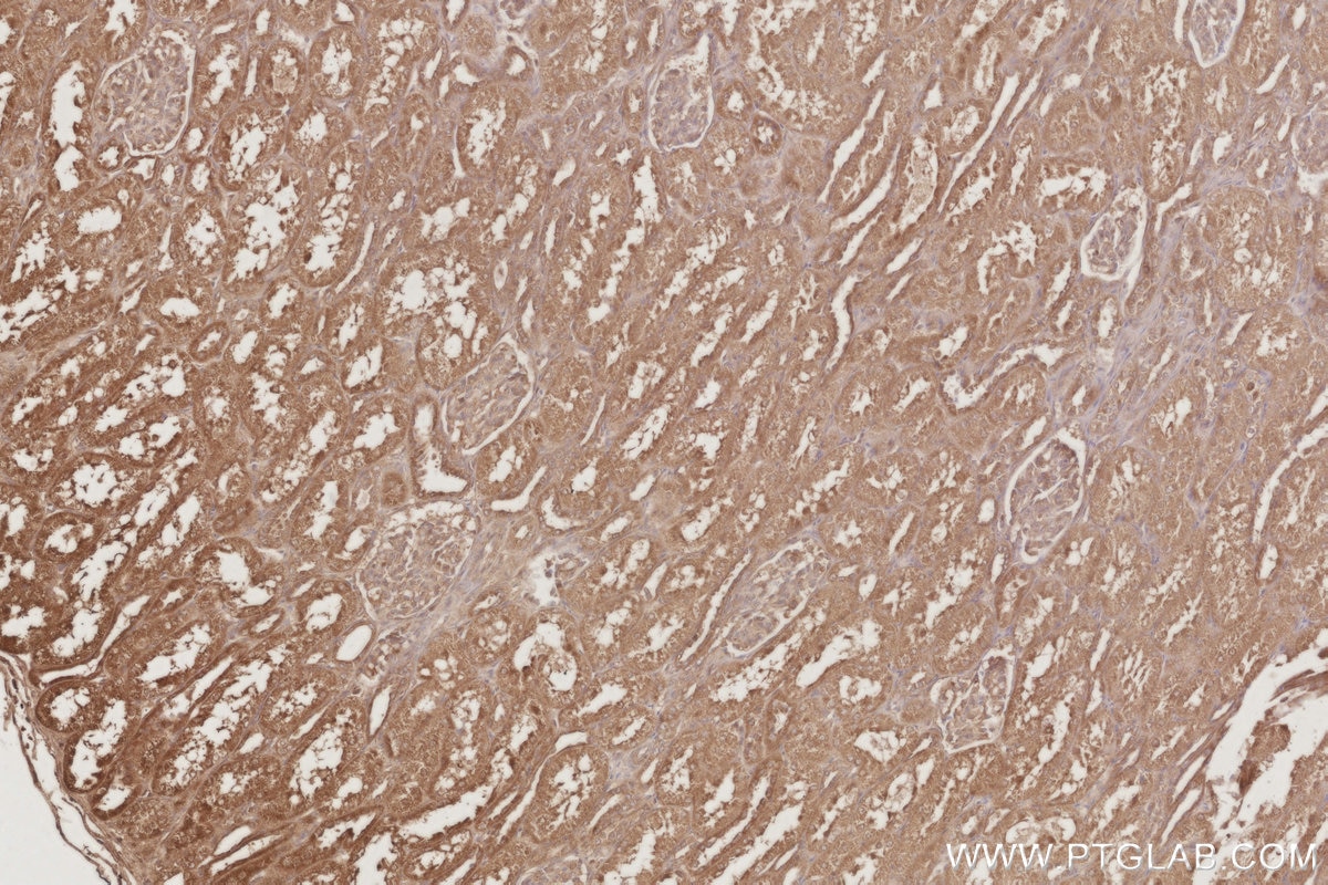 IHC staining of human kidney using 16433-1-AP Immunohistochemistry (IHC) staining of human kidney tissue using STYXL1 Polyclonal antibody (16433-1-AP)