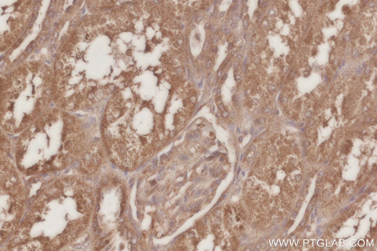 IHC staining of human kidney using 16433-1-AP Immunohistochemistry (IHC) staining of human kidney tissue using STYXL1 Polyclonal antibody (16433-1-AP)