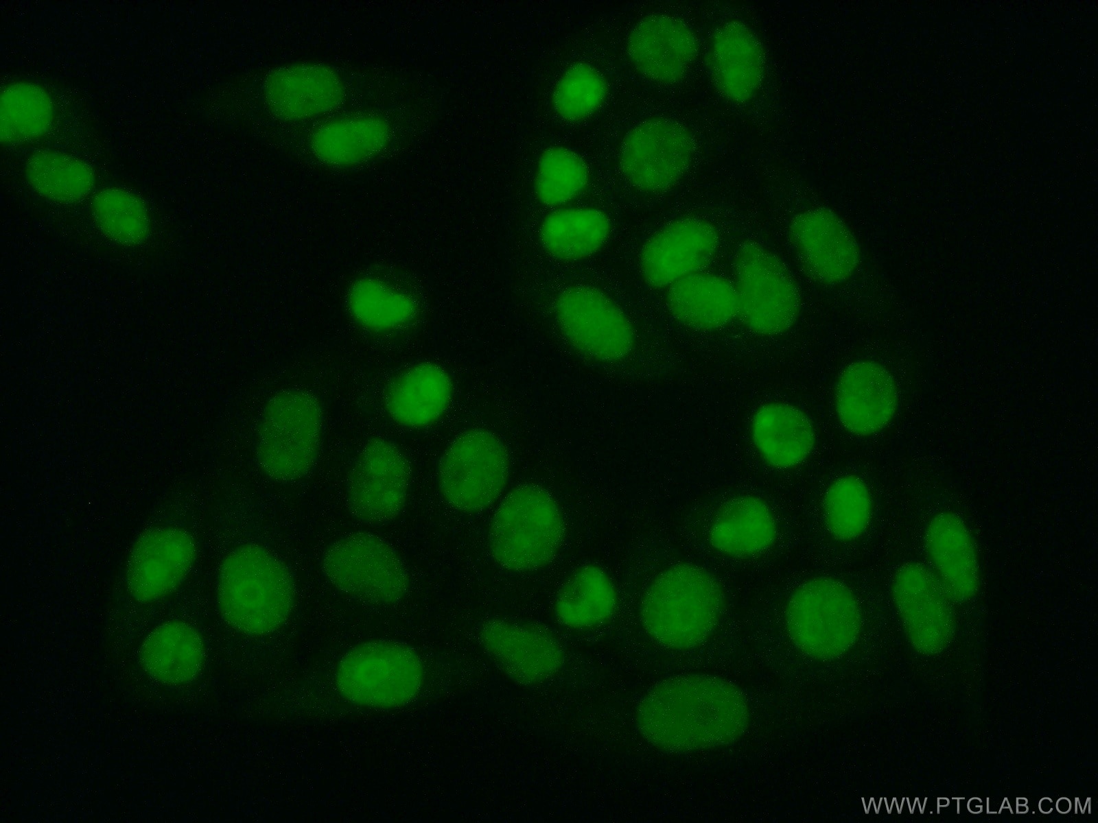 Immunofluorescence (IF) / fluorescent staining of HeLa cells using SUB1 Polyclonal antibody (10948-2-AP)