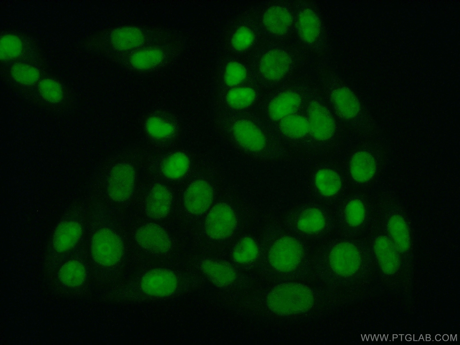 Immunofluorescence (IF) / fluorescent staining of HeLa cells using SUB1 Polyclonal antibody (10948-2-AP)