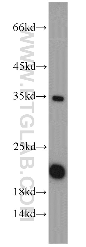 WB analysis of HeLa using 10948-2-AP