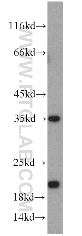 Western Blot (WB) analysis of A549 cells using SUB1 Polyclonal antibody (10948-2-AP)