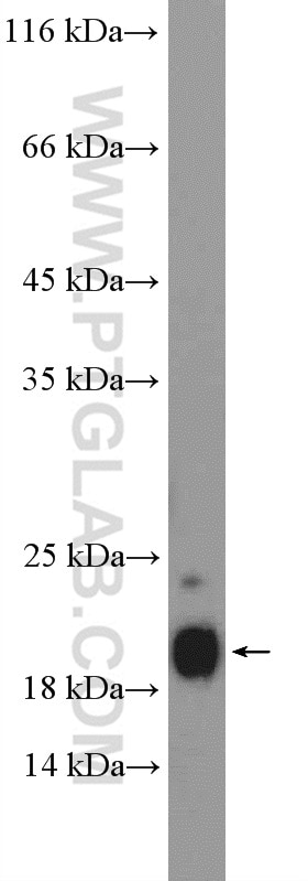 Western Blot (WB) analysis of rat liver tissue using SUB1 Polyclonal antibody (11956-1-AP)