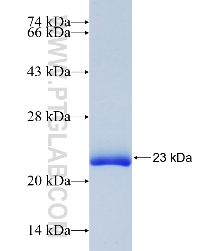 SUB1 fusion protein Ag22878 SDS-PAGE