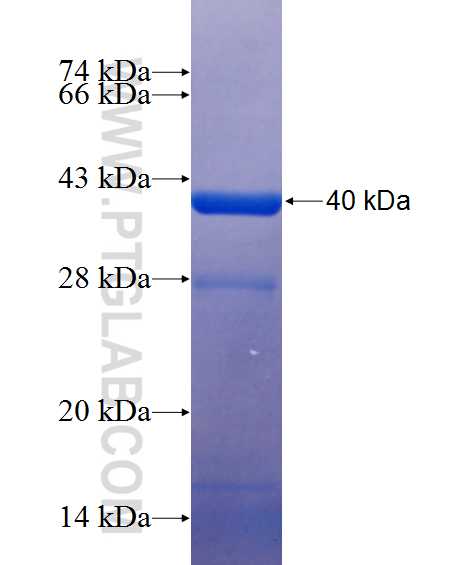SUB1 fusion protein Ag1390 SDS-PAGE