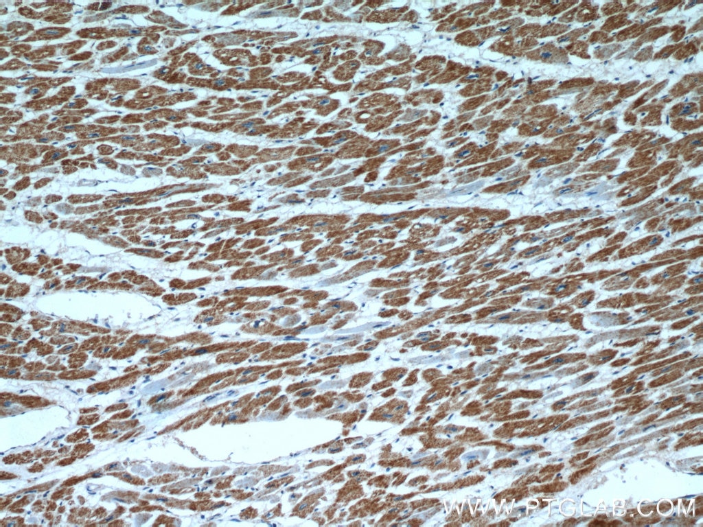 IHC staining of human heart using 12627-1-AP