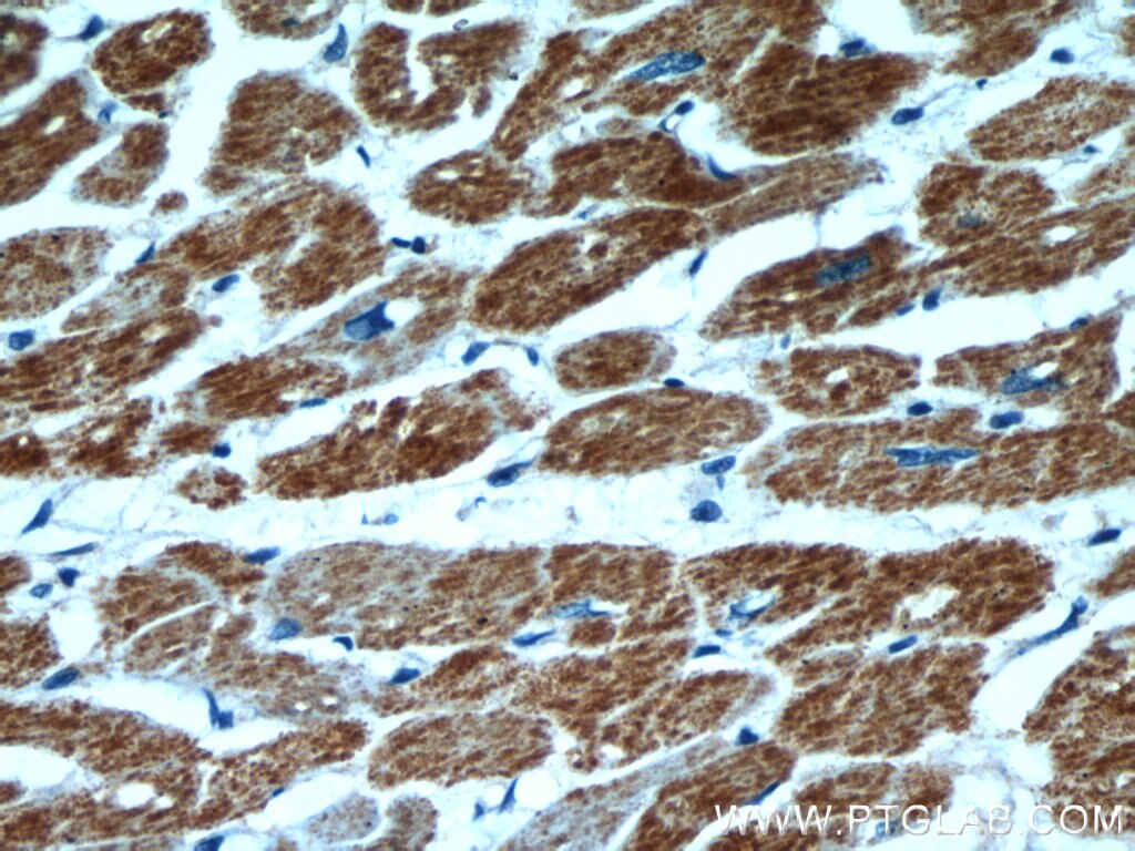 Immunohistochemistry (IHC) staining of human heart tissue using SUCLA2 Polyclonal antibody (12627-1-AP)