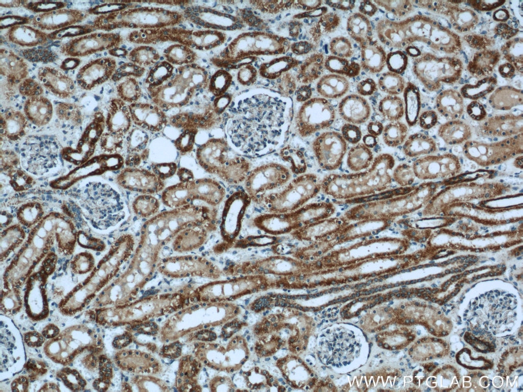 Immunohistochemistry (IHC) staining of human kidney tissue using SUCLA2 Polyclonal antibody (12627-1-AP)