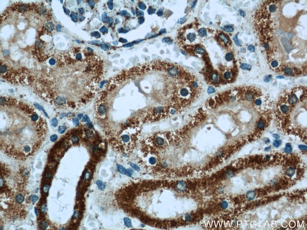 Immunohistochemistry (IHC) staining of human kidney tissue using SUCLA2 Polyclonal antibody (12627-1-AP)