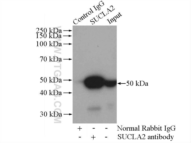 Immunoprecipitation (IP) experiment of HEK-293 cells using SUCLA2 Polyclonal antibody (12627-1-AP)