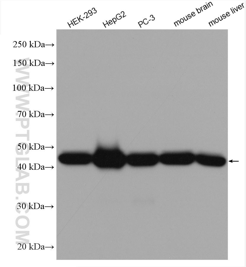 Western Blot (WB) analysis of HEK-293 cells using SUCLA2 Polyclonal antibody (12627-1-AP)