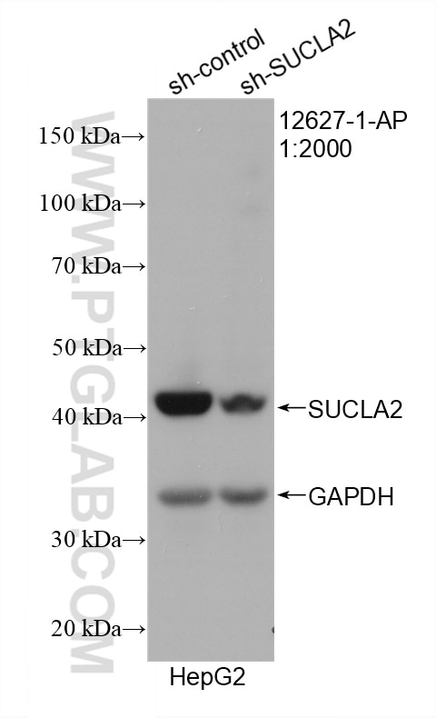 Western Blot (WB) analysis of HepG2 cells using SUCLA2 Polyclonal antibody (12627-1-AP)