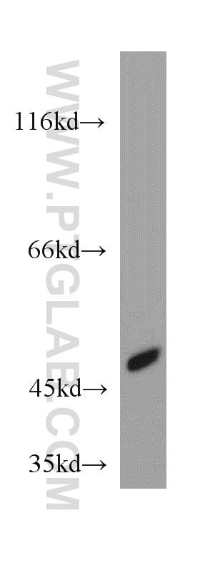 Western Blot (WB) analysis of SH-SY5Y cells using SUCLA2 Polyclonal antibody (12627-1-AP)