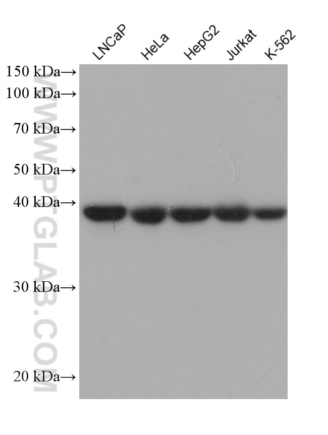 Western Blot (WB) analysis of various lysates using SUCLA2 Monoclonal antibody (68549-1-Ig)