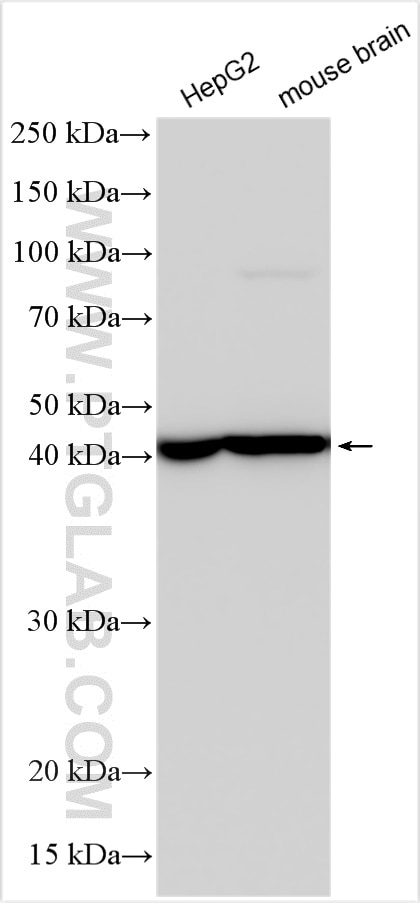 Western Blot (WB) analysis of various lysates using SUCLA2 Monoclonal antibody (68549-1-Ig)