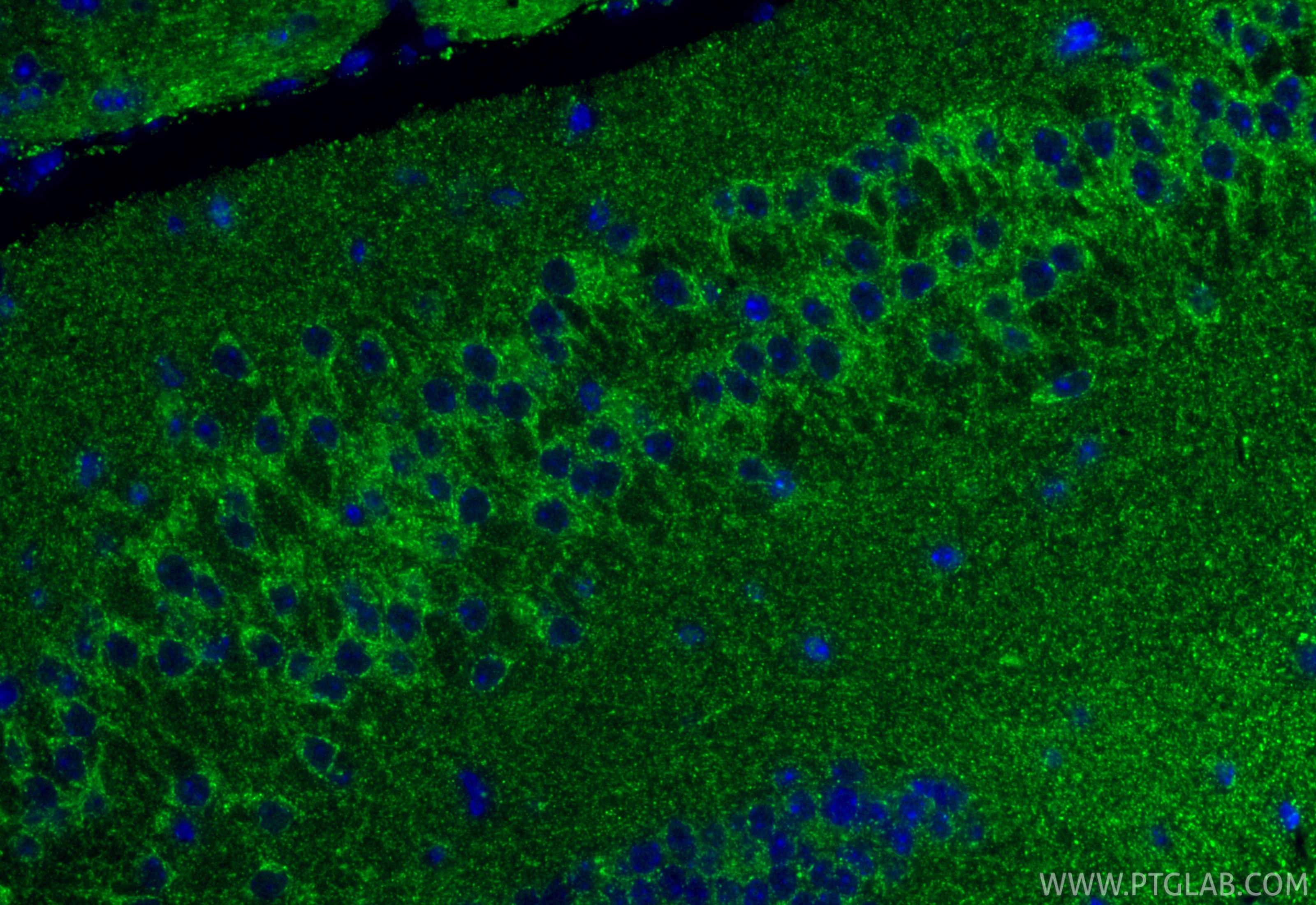 Immunofluorescence (IF) / fluorescent staining of mouse brain tissue using SUCLG1 Polyclonal antibody (14923-1-AP)