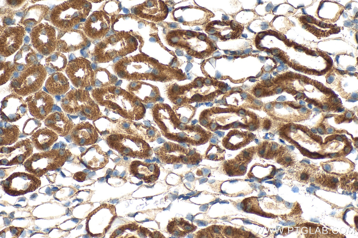 Immunohistochemistry (IHC) staining of mouse kidney tissue using SUCLG1 Polyclonal antibody (14923-1-AP)