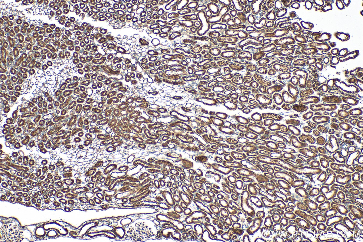 Immunohistochemistry (IHC) staining of mouse kidney tissue using SUCLG1 Polyclonal antibody (14923-1-AP)