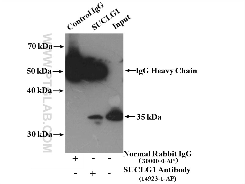 Immunoprecipitation (IP) experiment of mouse kidney tissue using SUCLG1 Polyclonal antibody (14923-1-AP)
