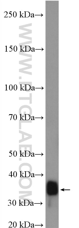 Western Blot (WB) analysis of rat liver tissue using SUCLG1 Polyclonal antibody (14923-1-AP)