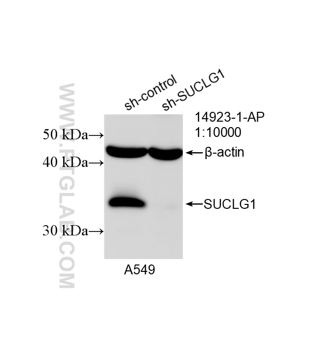 Western Blot (WB) analysis of A549 cells using SUCLG1 Polyclonal antibody (14923-1-AP)