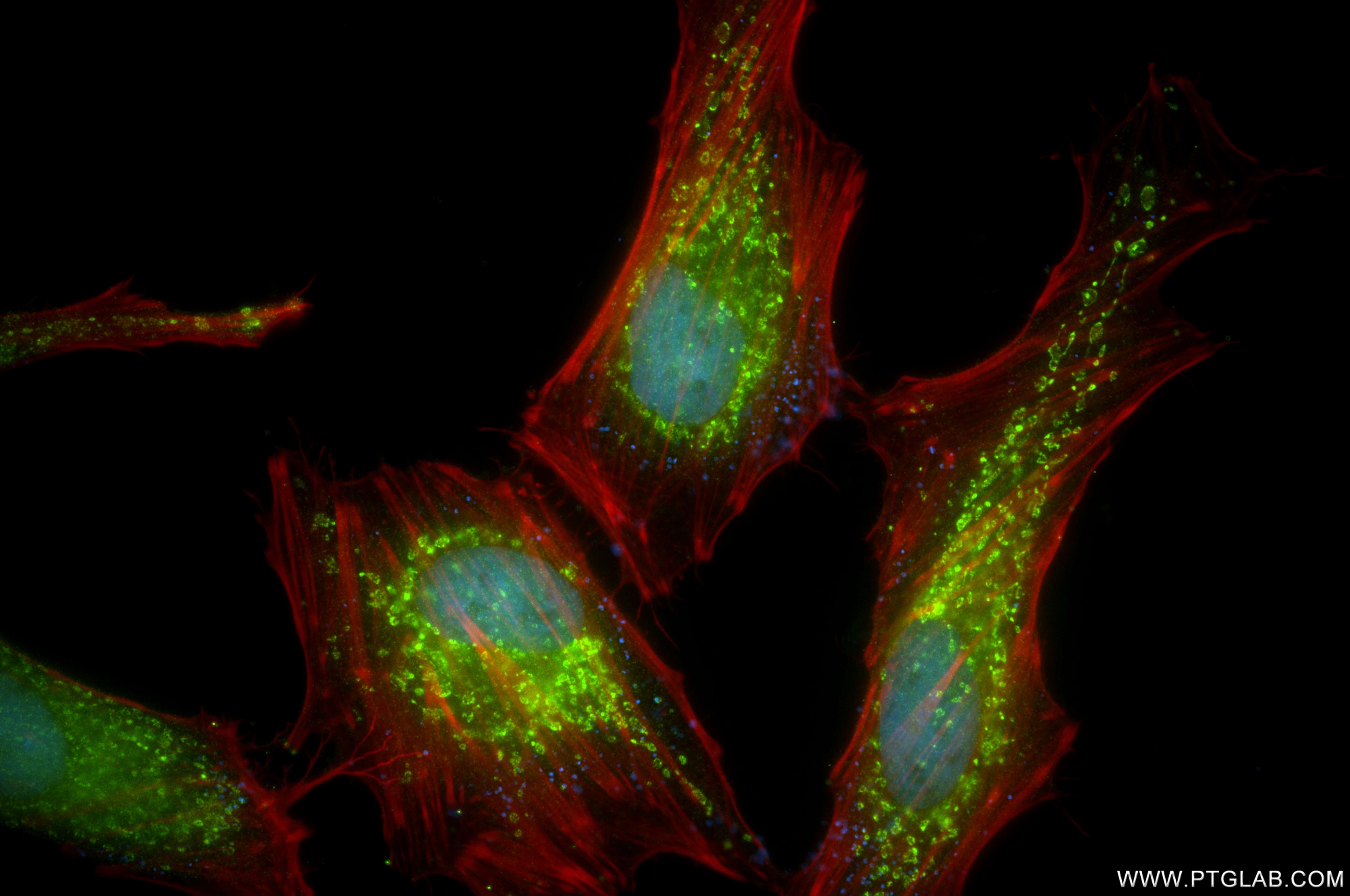 Immunofluorescence (IF) / fluorescent staining of HeLa cells using SUCLG1 Recombinant antibody (86072-1-RR)