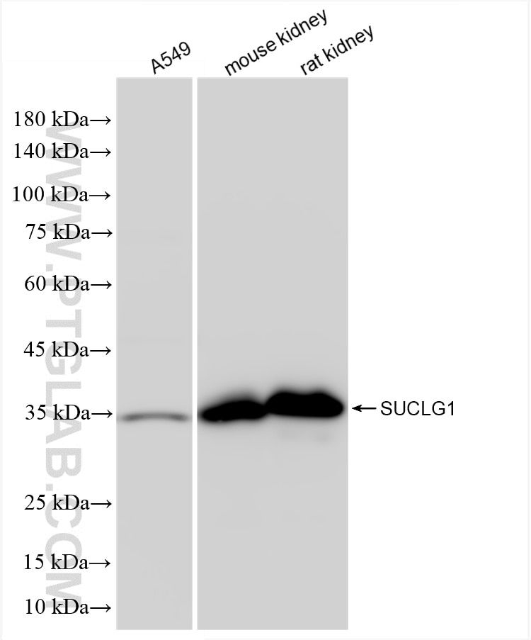 SUCLG1
