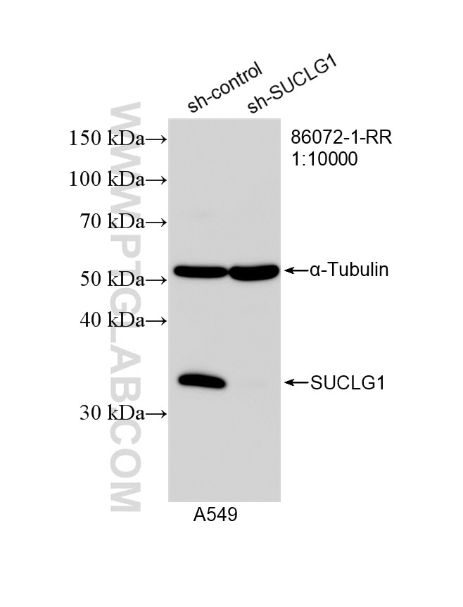 Western Blot (WB) analysis of A549 cells using SUCLG1 Recombinant monoclonal antibody (86072-1-RR)