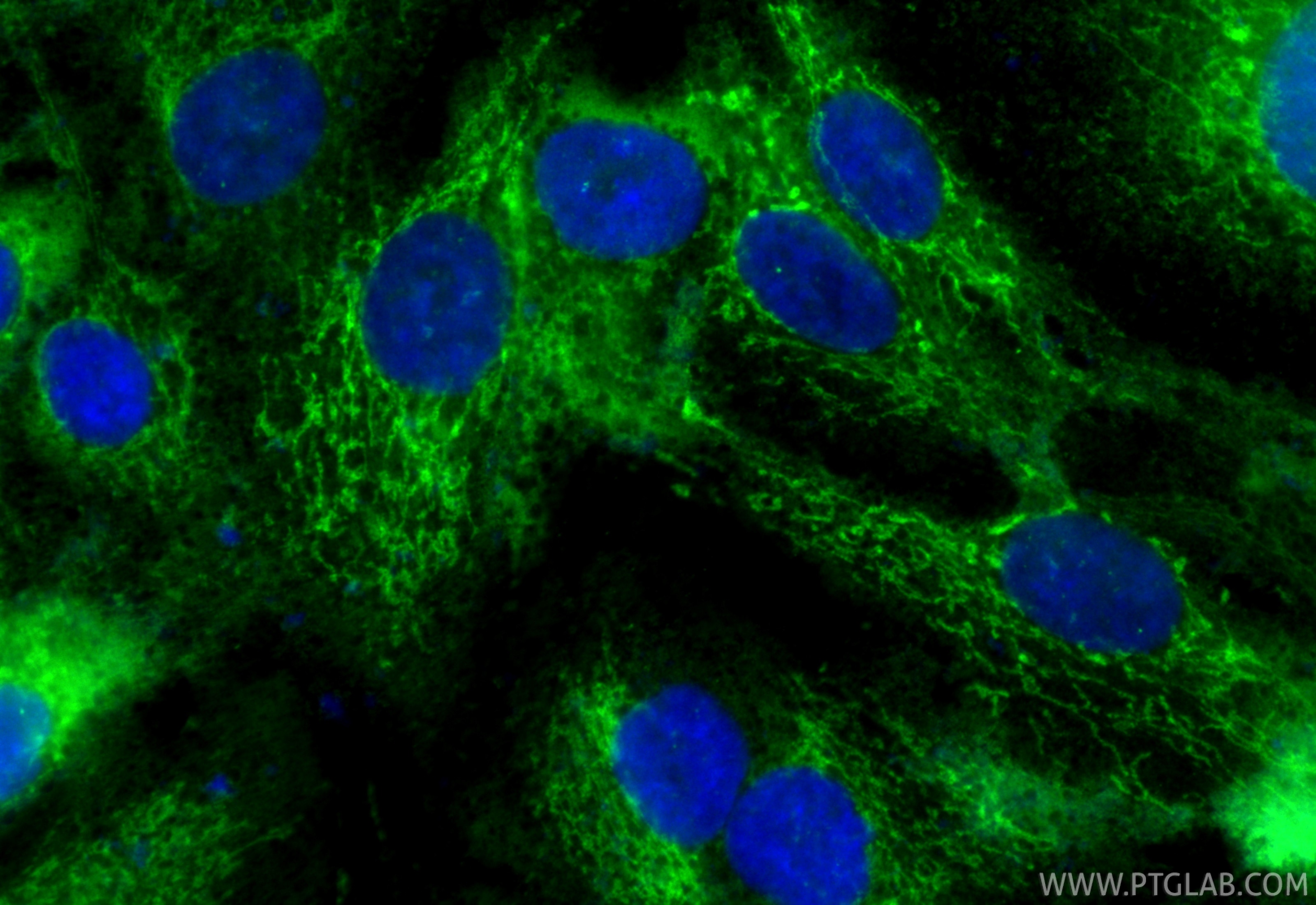 Immunofluorescence (IF) / fluorescent staining of A549 cells using CoraLite® Plus 488-conjugated SUCLG1 Recombinant m (CL488-86072)