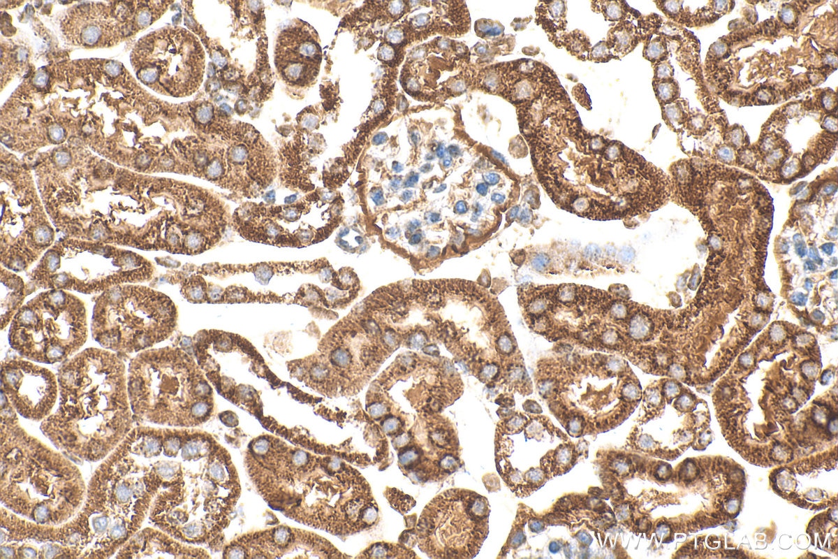 Immunohistochemistry (IHC) staining of mouse kidney tissue using SUCLG2 Polyclonal antibody (14240-1-AP)