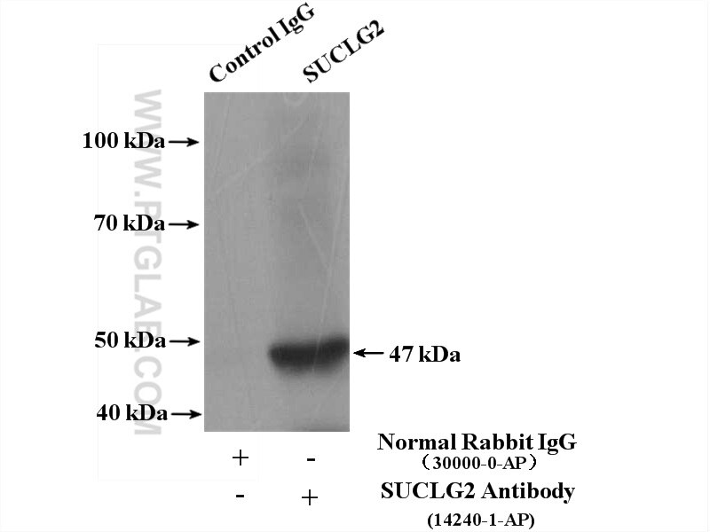Immunoprecipitation (IP) experiment of mouse kidney tissue using SUCLG2 Polyclonal antibody (14240-1-AP)