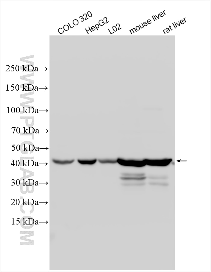 Western Blot (WB) analysis of various lysates using SUCLG2 Polyclonal antibody (14240-1-AP)