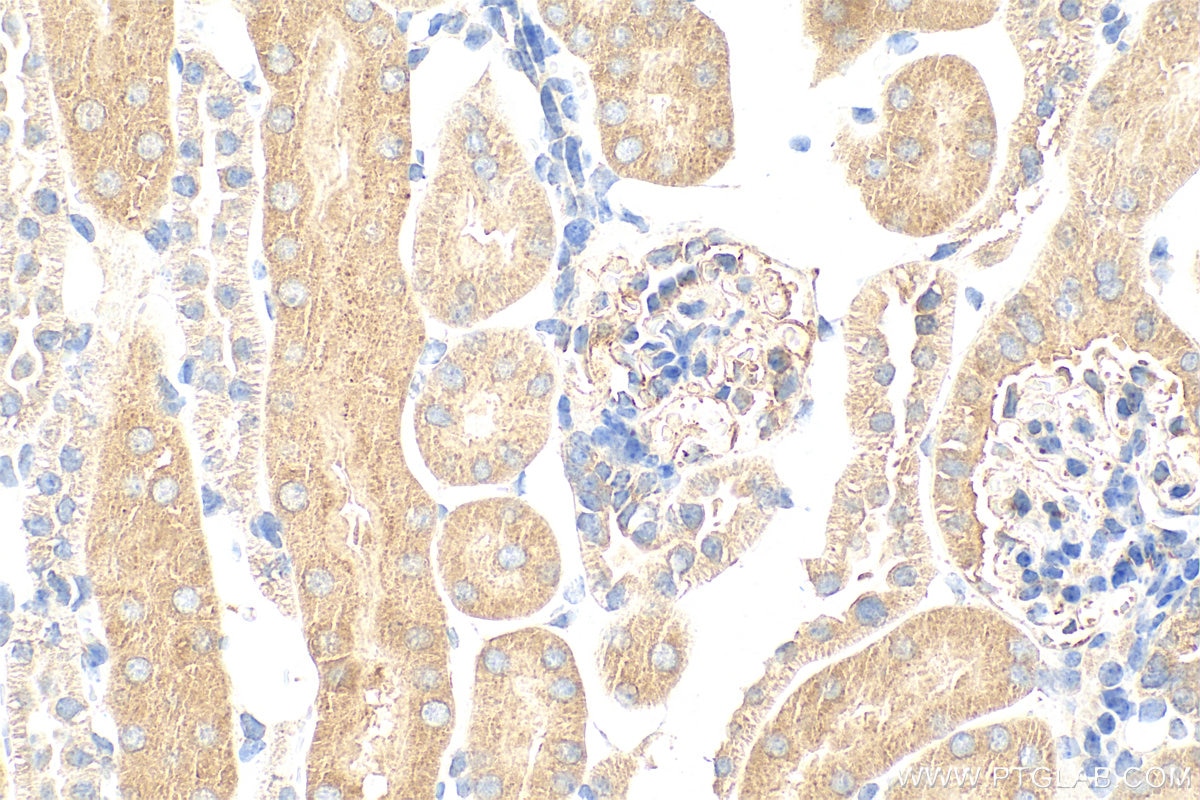 Immunohistochemistry (IHC) staining of mouse kidney tissue using SUCNR1 Polyclonal antibody (31987-1-AP)