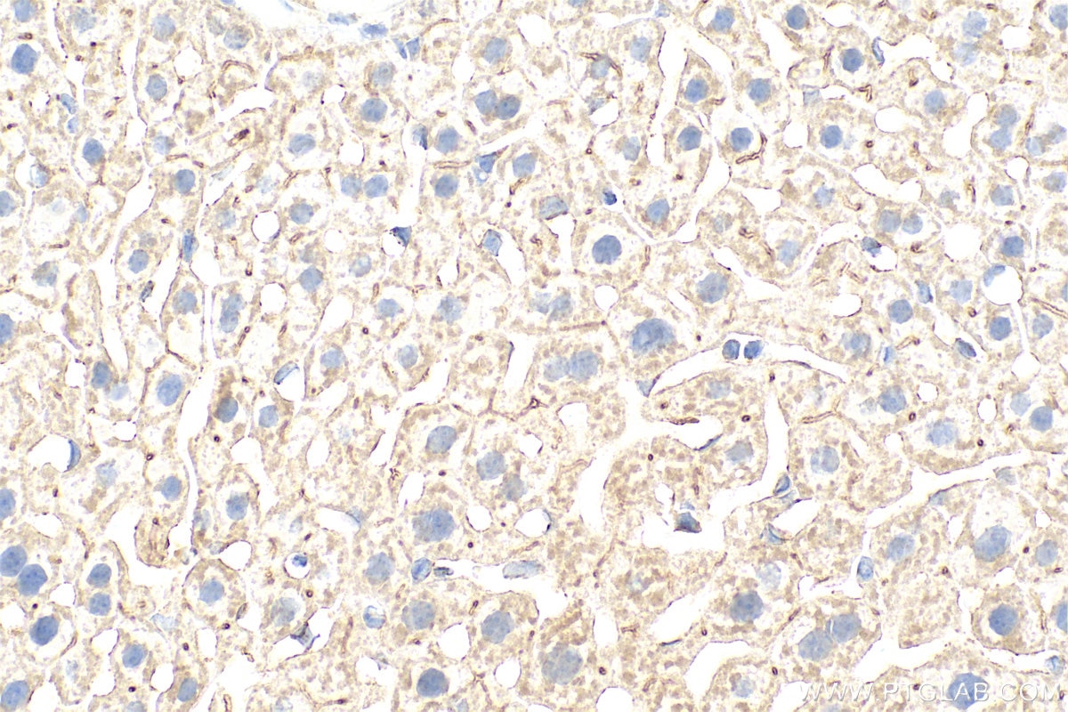 Immunohistochemistry (IHC) staining of mouse liver tissue using SUCNR1 Polyclonal antibody (31987-1-AP)