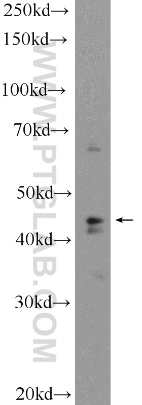 Western Blot (WB) analysis of HL-60 cells using SUDS3 Polyclonal antibody (25845-1-AP)