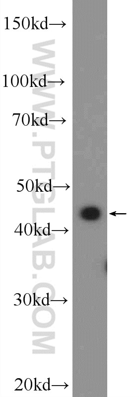 Western Blot (WB) analysis of Raji cells using SUDS3 Polyclonal antibody (25845-1-AP)