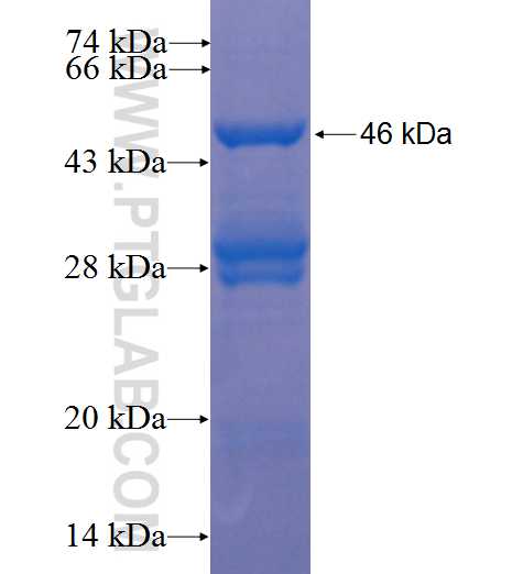 SUDS3 fusion protein Ag22961 SDS-PAGE