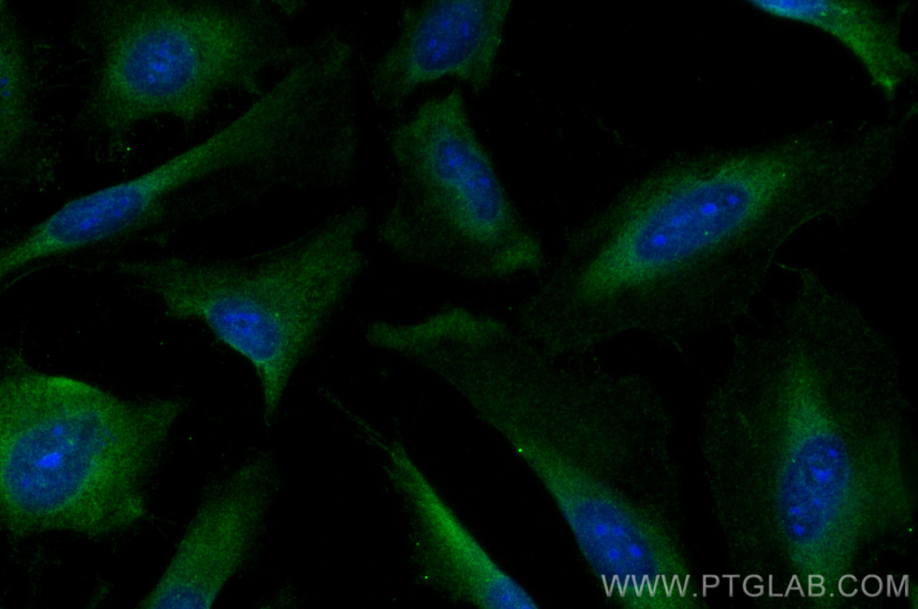 Immunofluorescence (IF) / fluorescent staining of HeLa cells using SUFU Polyclonal antibody (26759-1-AP)