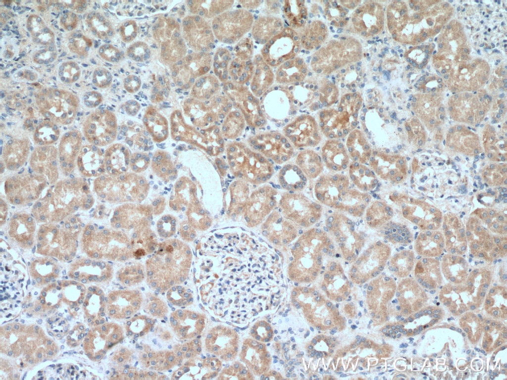 Immunohistochemistry (IHC) staining of human kidney tissue using SUFU Polyclonal antibody (26759-1-AP)