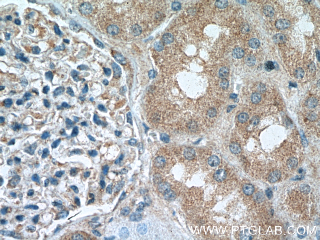 Immunohistochemistry (IHC) staining of human kidney tissue using SUFU Polyclonal antibody (26759-1-AP)