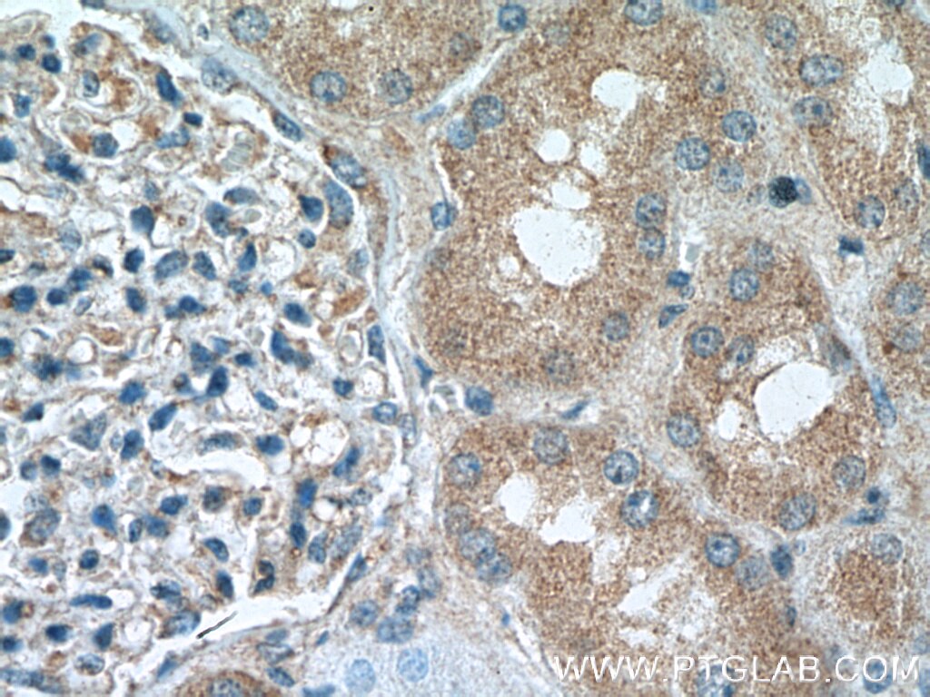 IHC staining of human kidney using 26759-1-AP