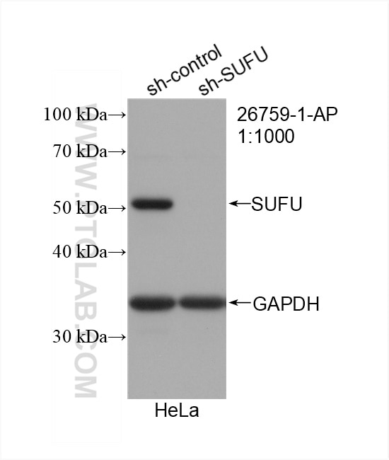 Western Blot (WB) analysis of HeLa cells using SUFU Polyclonal antibody (26759-1-AP)