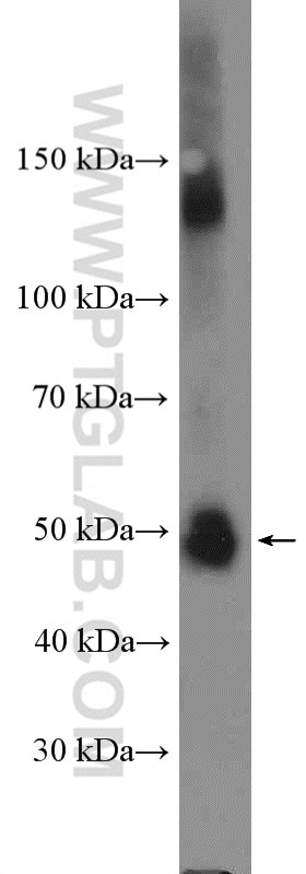 Western Blot (WB) analysis of HEK-293 cells using SUFU Polyclonal antibody (26759-1-AP)