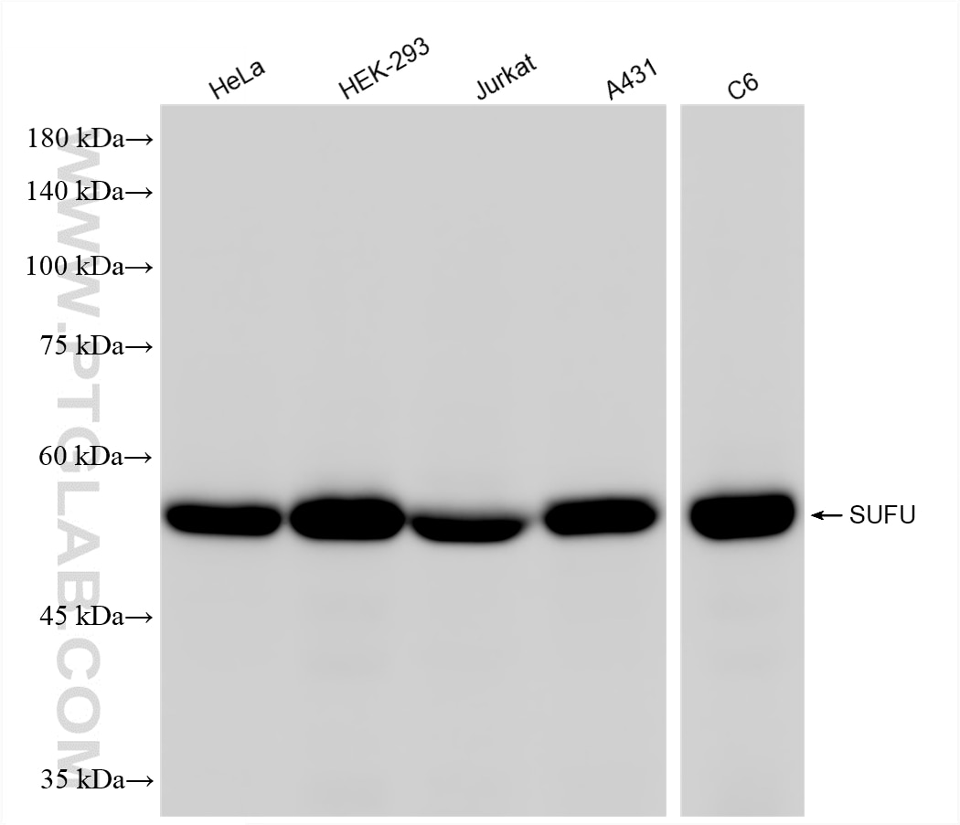 Western Blot (WB) analysis of various lysates using SUFU Recombinant monoclonal antibody (87724-1-RR)