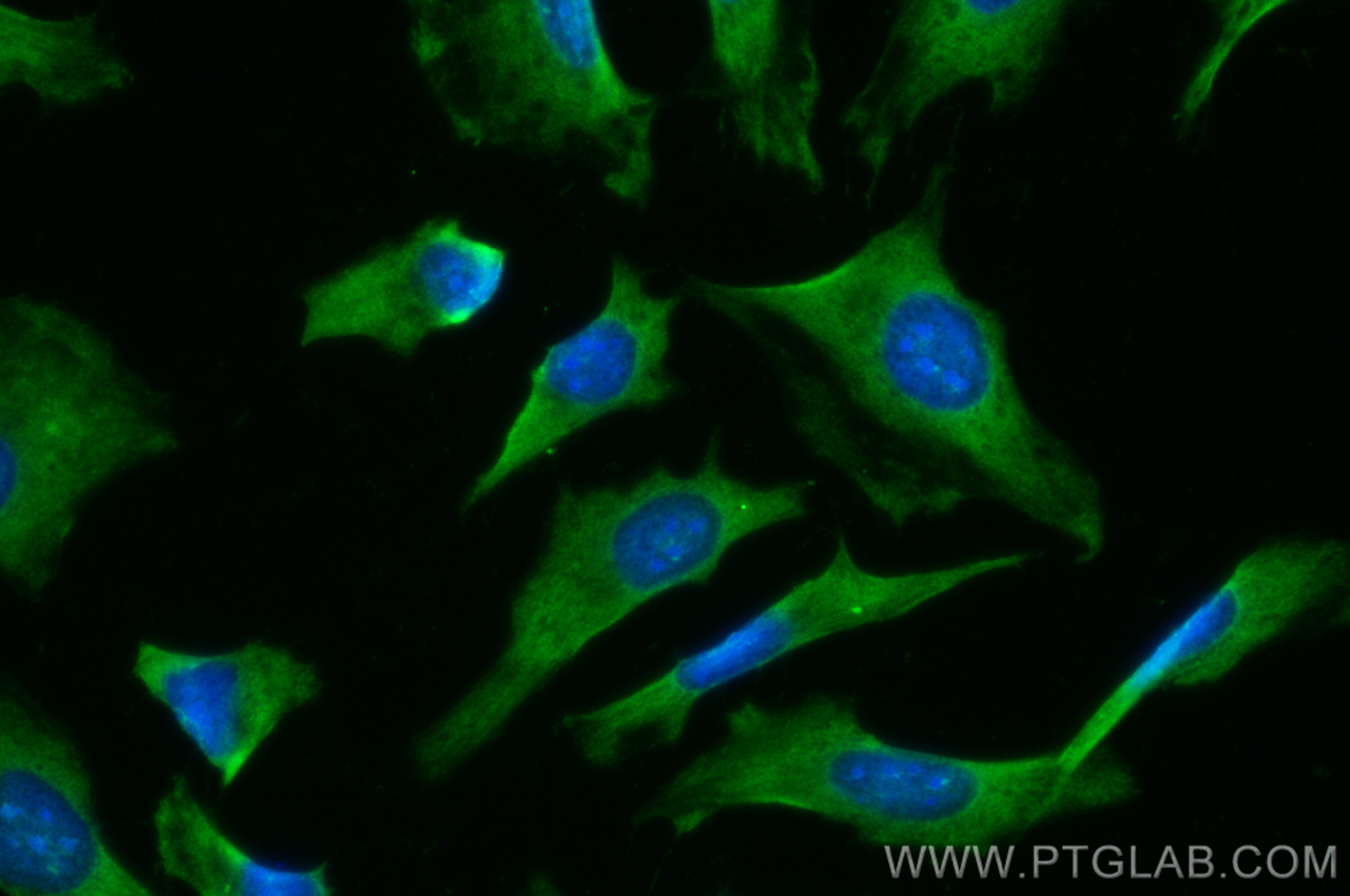 Immunofluorescence (IF) / fluorescent staining of HeLa cells using CoraLite® Plus 488-conjugated SUFU Polyclonal anti (CL488-26759)