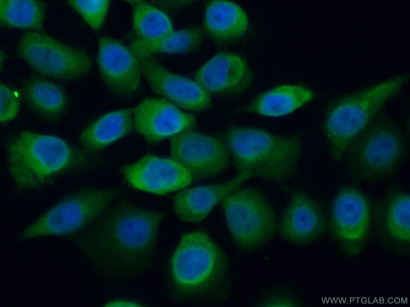 Immunofluorescence (IF) / fluorescent staining of A431 cells using SUGT1 Polyclonal antibody (11675-1-AP)