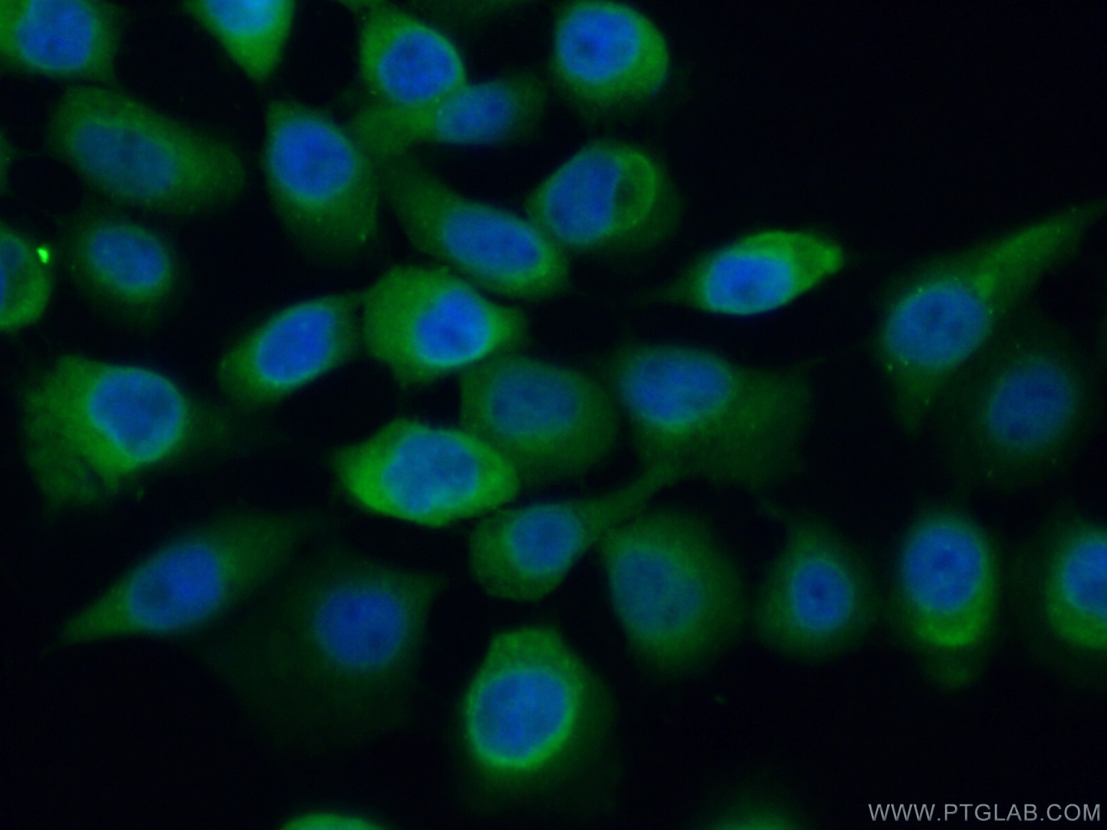 IF Staining of A431 using 11675-1-AP