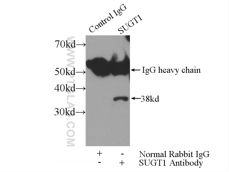 Immunoprecipitation (IP) experiment of HEK-293 cells using SUGT1 Polyclonal antibody (11675-1-AP)