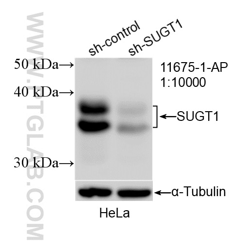 Western Blot (WB) analysis of HeLa cells using SUGT1 Polyclonal antibody (11675-1-AP)