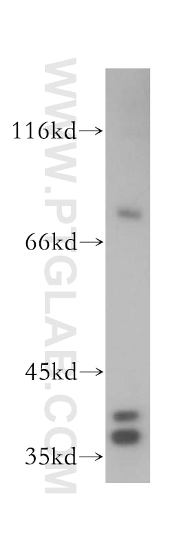 Western Blot (WB) analysis of Jurkat cells using SUGT1 Polyclonal antibody (11675-1-AP)